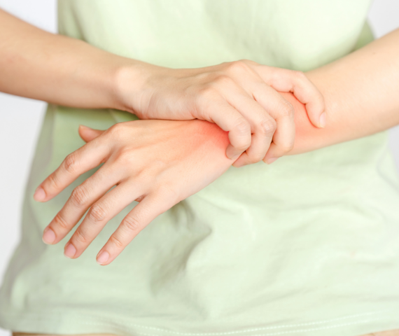arthritis management