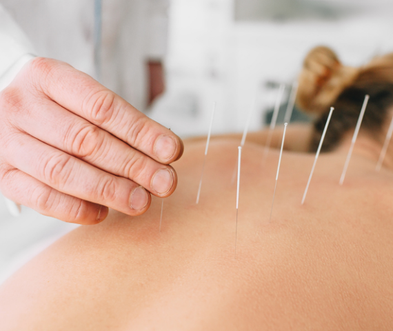 cosmo acupuncture